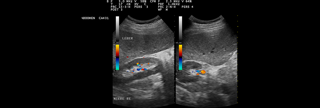 Ultraschall Bauchorgane